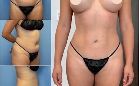 How Best Body Contouring Surgeons in Dubai Deliver Stunning Body Contouring Results
