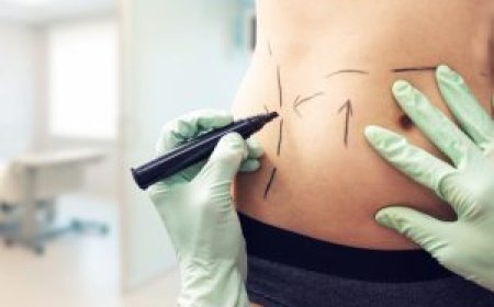 Abdominoplasty Dubai: Post-Surgery Tips for a Smooth Recovery