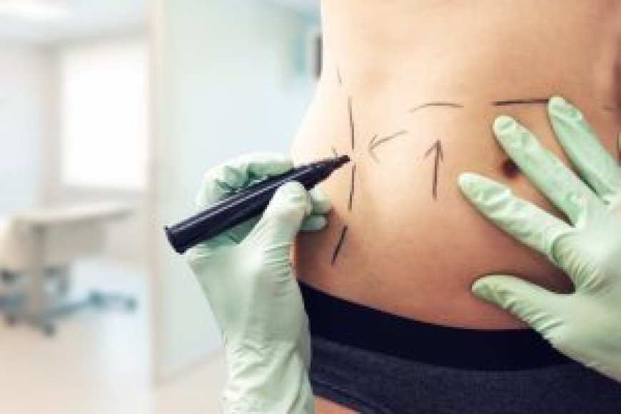 Abdominoplasty Dubai: Post-Surgery Tips for a Smooth Recovery