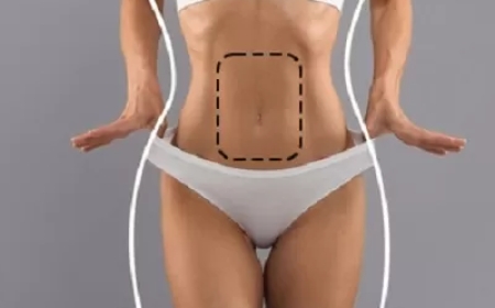 Liposuction vs. CoolSculpting in Dubai: Which Fat Removal Method Wins?