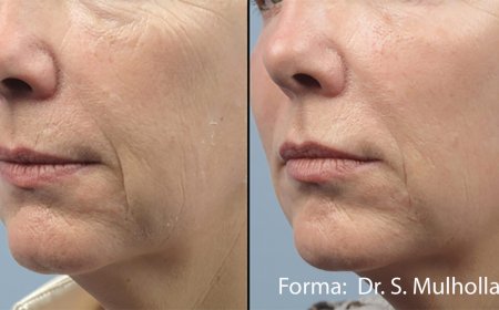Achieve Youthful Radiance with Advanced Skin Tightening in Tysons Corner