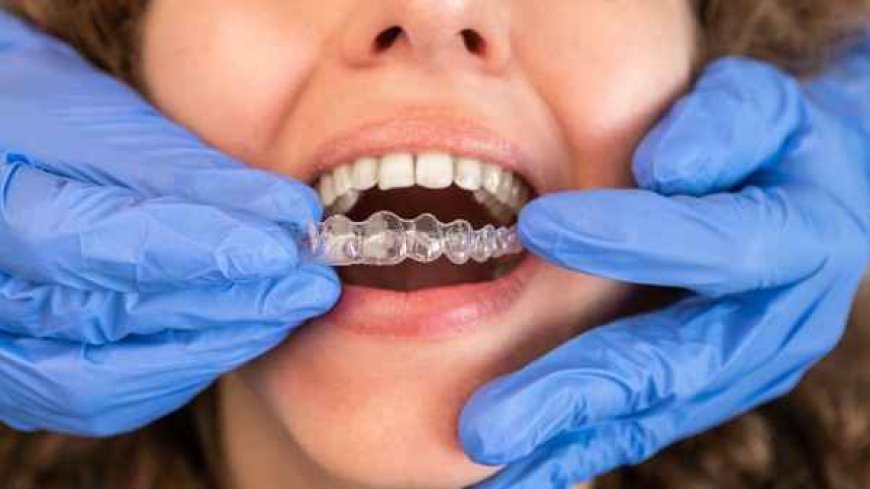 Taking Aligners to the Shore? Here’s Your Quick Guide