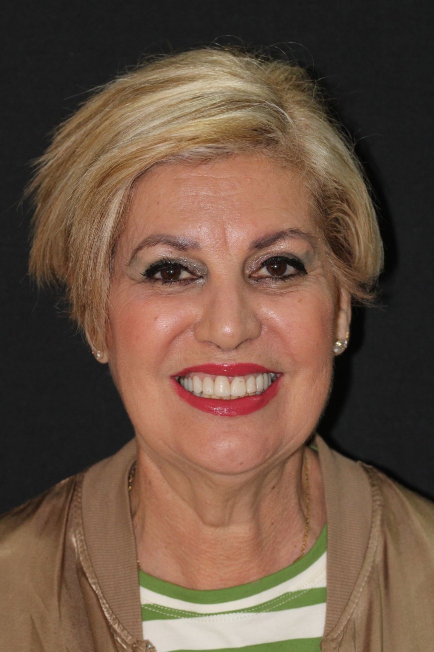 Clínica Dental en Hospitalet de Llobregat Tu Mejor Opción en Salud Bucal