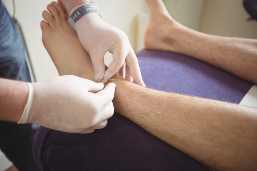 Understanding Varicose Vein Treatment Options in San Antonio