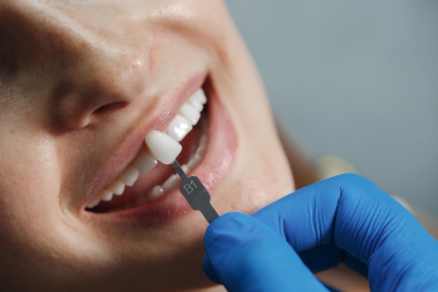 What Are Zirconia Crowns? Benefits, Process, and Care Tips Explained